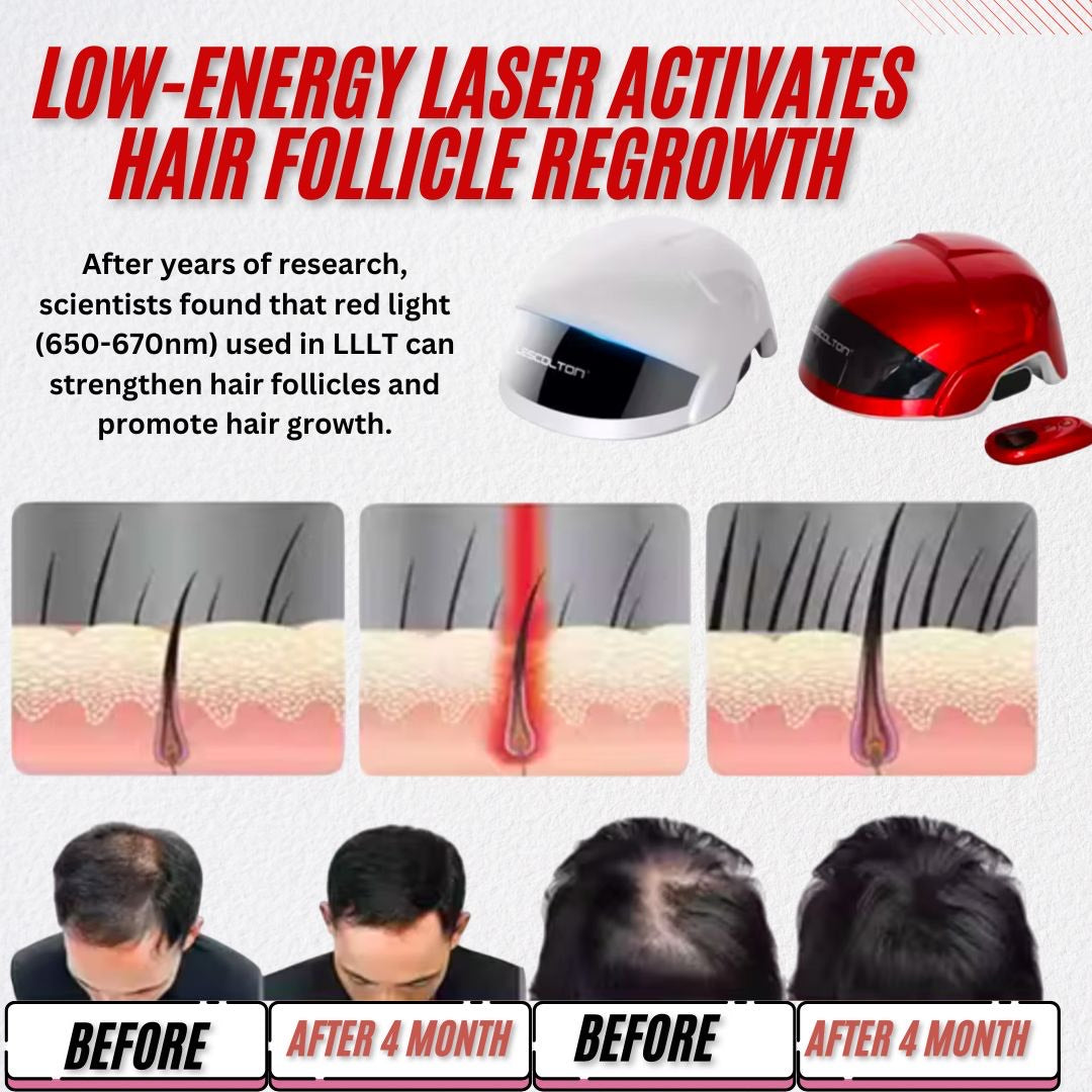 LED HairRestore Helmet